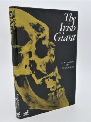 The Irish Giant (1976)