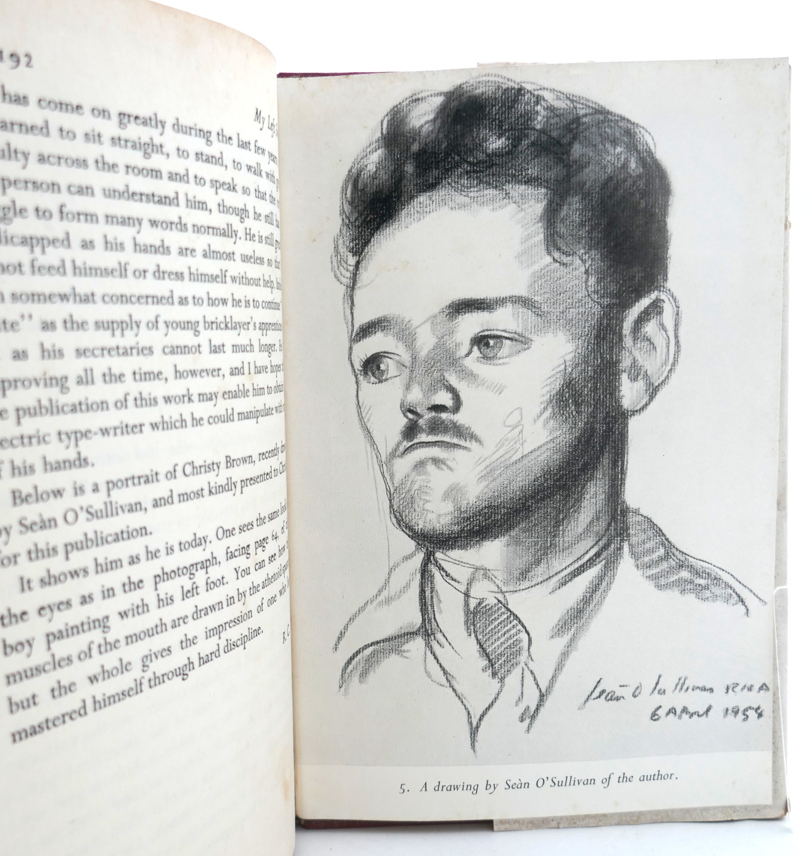 My Left Foot. Foreword by Dr. Robert Collis (1954) - Image 10